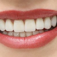 Kush ndikon në përkeqësimin e shëndetit të dhëmbëve?